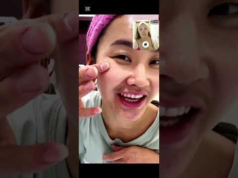 Видео: Day #5 Цагаан батганаасаа амархан бас өвдөхгүйгээр салсан нь. 