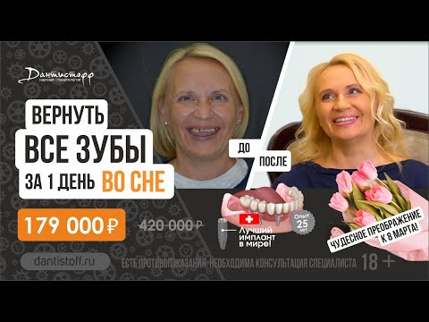 Видео: Протезирование зубов на имплантах All on 4. +7 (495) 255-59-37 Преображение пациентки к 8 марта! 18+