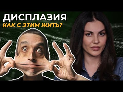 Видео: ДСТ: дисплазия соединительной ткани