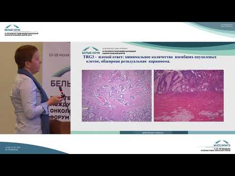 Видео: Оценка лечебного патоморфоза при раке прямой кишки. Подходы, результаты