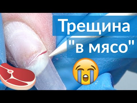 Видео: Трещина на ногте 😱 Что делать? Ремонт без снятия ногтя