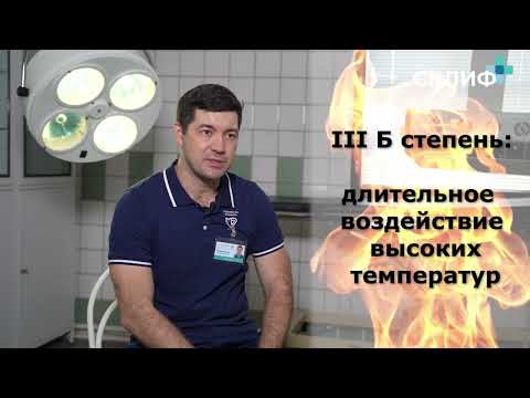 Видео: Как лечить ожоги? Как считают площадь ожогов на теле? Кто такой комбустиолог?