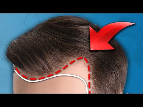 Видео: Фактор №1, который часто упускают из виду при борьбе с выпадением волос