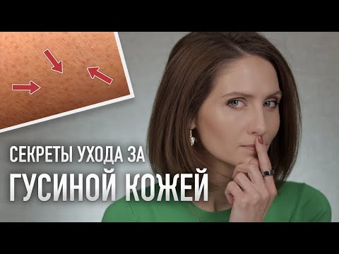 Видео: УХОД ЗА ТЕЛОМ ДОМА || Схема ухода при фолликулярном кератозе и любимые средства