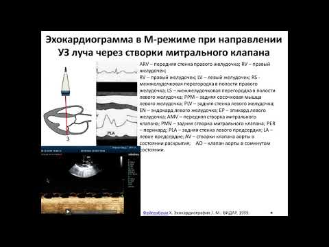 Видео: Основы ЭхоКГ. М-режим (2 часть). 10122019