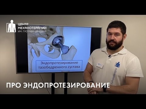 Видео: Эндопротезирование тазобедренного сустава: показания, типа протезов, важные нюансы.