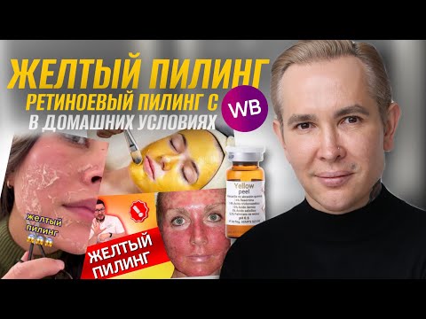 Видео: Желтый пилинг в домашних условиях. Сам себе косметолог | Ретиноевый пилинг WB опасность! #пилинглица