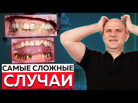 Видео: Вернули 10 лет жизни клиенту! Топ 3 самых сложных стоматологических случаев