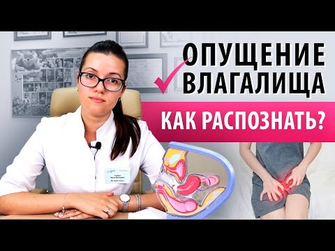 Видео: Опущение стенок влагалища. Как диагностировать в домашних условиях?Я здорова