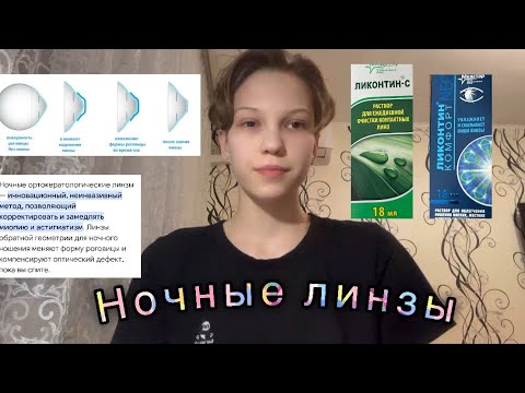 Видео: Ночные линзы.| Мой опыт.