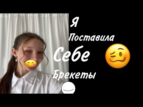 Видео: Поставила БРЕКЕТЫ/ Влог/ Моя история/Эмоции;)