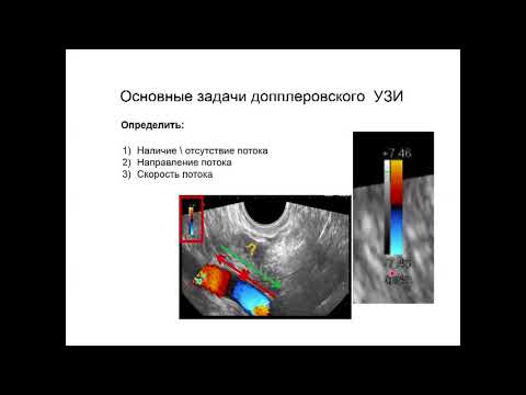 Видео: Введение в допплерографию с демонстрацией на пациенте