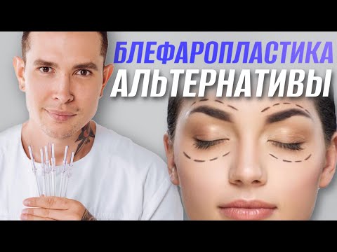 Видео: ОПУЩЕНИЕ ВЕРХНЕГО ВЕКА | Рабочие альтернативы блефаропластики #блефаропластика