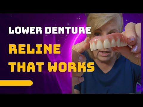 Видео: Как лучше приспособить нижний зубной протез