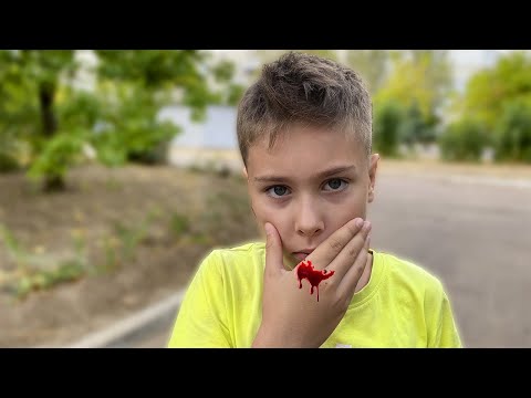 Видео: У Серёжи ВЫПАЛ ЗУБ ! Мама у стоматолога ! Наш день Fast family
