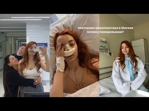 Видео: риносептопластика в Москве, почему пришлось переделывать нос?