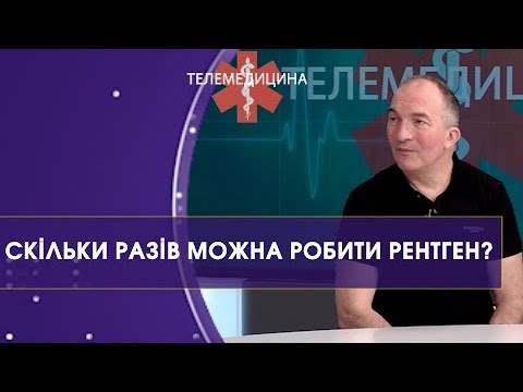 Видео: Рентген, КТ чи МРТ — що обрати для діагностики організму | Телемедицина