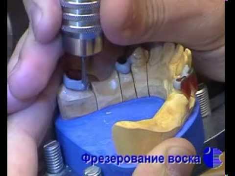 Видео: Этапы изгтовления бюгельных протезов (часть 2)