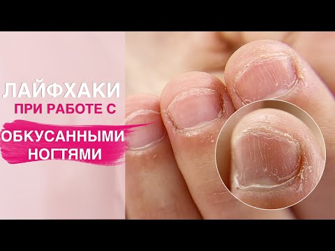 Видео: Лайфхаки маникюра на ОБКУСАННЫЕ ногти