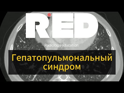 Видео: Гепатопульмональный синдром