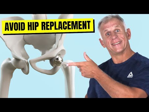 Видео: 5 упражнений для бедра, чтобы остановить боль и эндопротезирование тазобедренного сустава