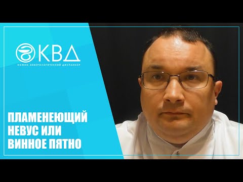 Видео: 1333  Пламенеющий невус или винное пятно