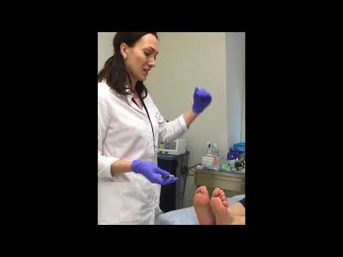 Видео: Как проверить поражены ли ноги диабетом