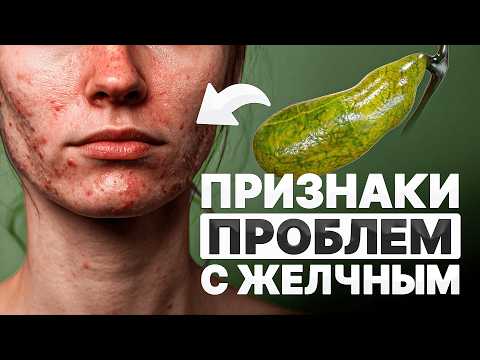 Видео: Желчный пузырь: как он влияет на твое самочувствие?