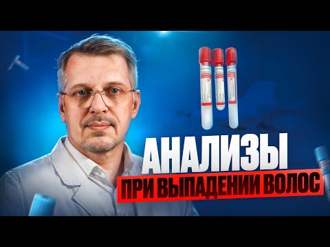 Видео: Анализы при выпадении волос