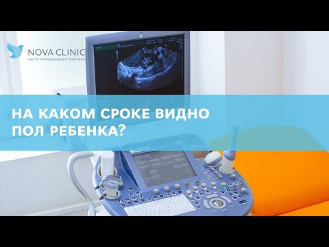 Видео: Когда видно пол ребенка на УЗИ?