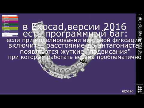 Видео: Баг моделировки в Exocad