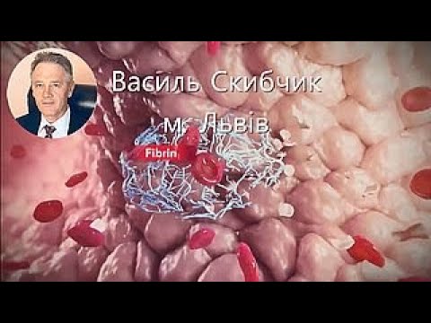 Видео: Василь Скибчик