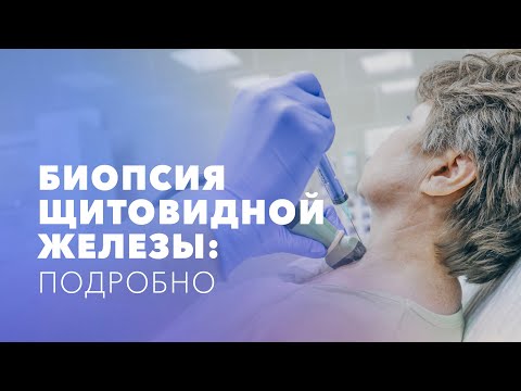 Видео: Биопсия щитовидной железы: как проводят процедуру? Тонкоигольная аспирационная биопсия