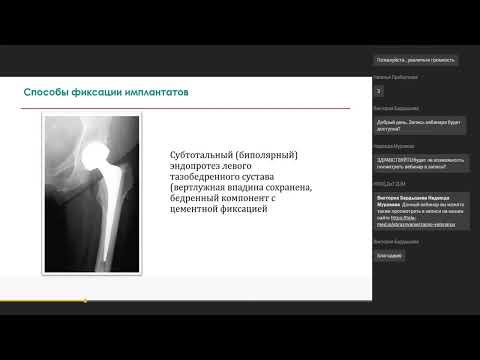 Видео: Рентгенологический контроль результатов эндопротезирования