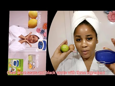 Видео: ВЫГЛЯДИТЕ ВСЕГДА НА 16!! С помощью вазелина, лимона и яичного белка. ЛИЦО КАК У ДЕТЕЙ