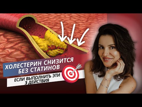 Видео: Холестерин снизится без статинов, если выполнить эти 3 действия
