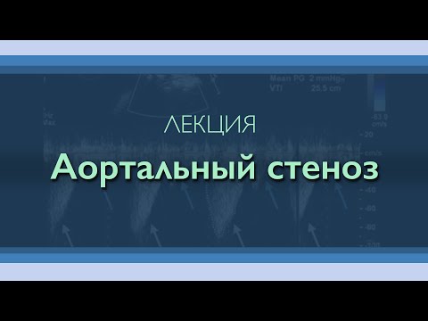 Видео: Аортальный стеноз