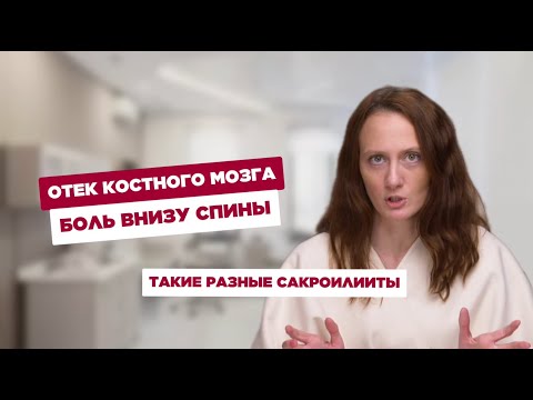 Видео: Болит крестец? Болезнь Бехтерева? Такие разные сакроилииты