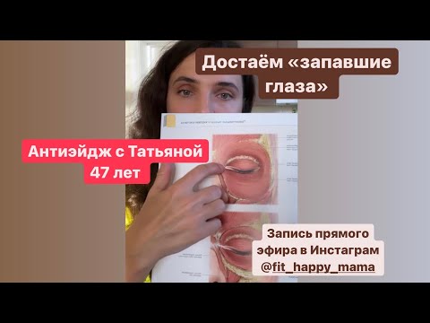 Видео: Достаём «запавшие глаза» омолаживающие техники