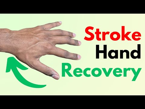 Видео: Восстановление пальцев и кисти после инсульта: упражнения для каждого этапа
