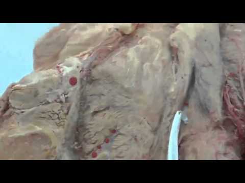 Видео: Мужская половая система.  Семявыносящие пути