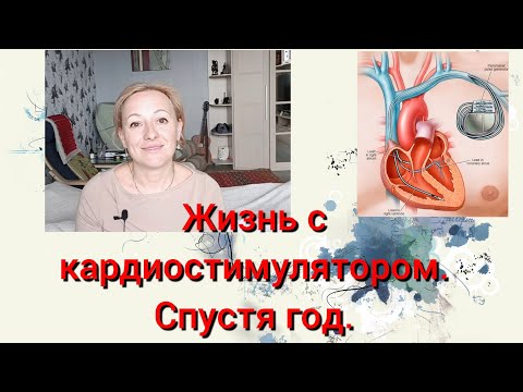 Видео: Жизнь с кардиостимулятором. Спустя год.