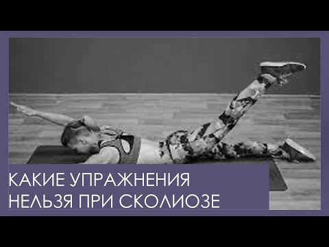 Видео: ЧТО ЗАПРЕЩЕНО ПРИ СКОЛИОЗЕ