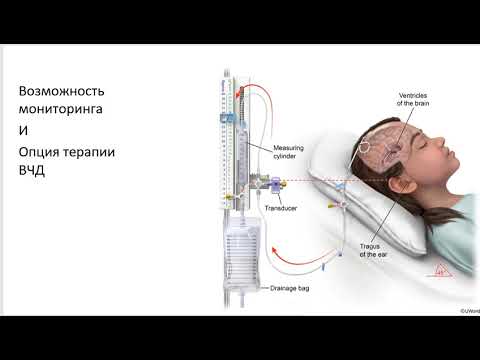 Видео: Мониторинг ВЧД при САК Савин И.А.