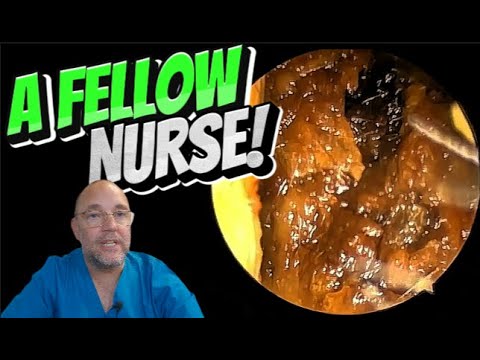 Видео: КОЛЛЕГА-МЕДСЕСТРА! 344 #ухо #асмр #удовлетворительно #длятебя #fyp #foryourpage