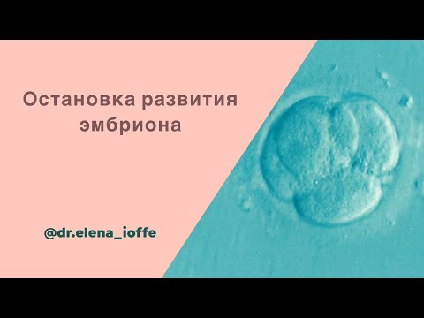 Видео: Остановка развития эмбриона.
