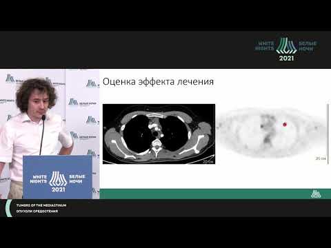Видео: Лучевая и радиоизотопная диагностика опухолей средостения  (Нестеров Д.В.)