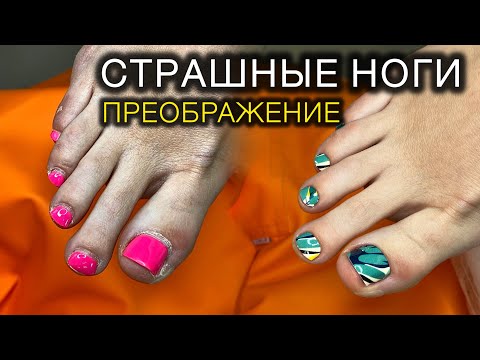 Видео: НЕКРАСИВЫЕ НОГИ  #педикюр #пленкивпедикюре #аленалаврентьева #подолог #дизайнногтей