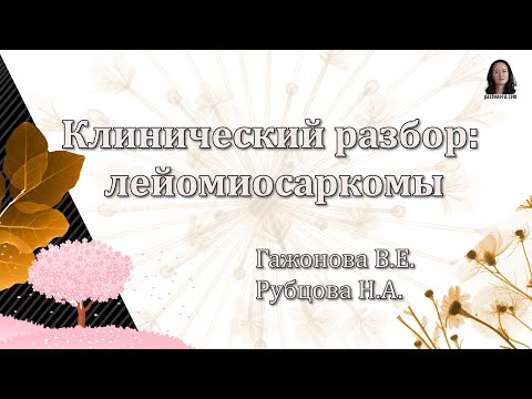 Видео: Клинический разбор - лейомиосаркомы. Проф. Гажонова В.Е., Рубцова Н.А