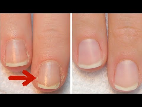 Видео: НЕВЕРОЯТНО ПРОСТАЯ маска от КУТИКУЛЫ